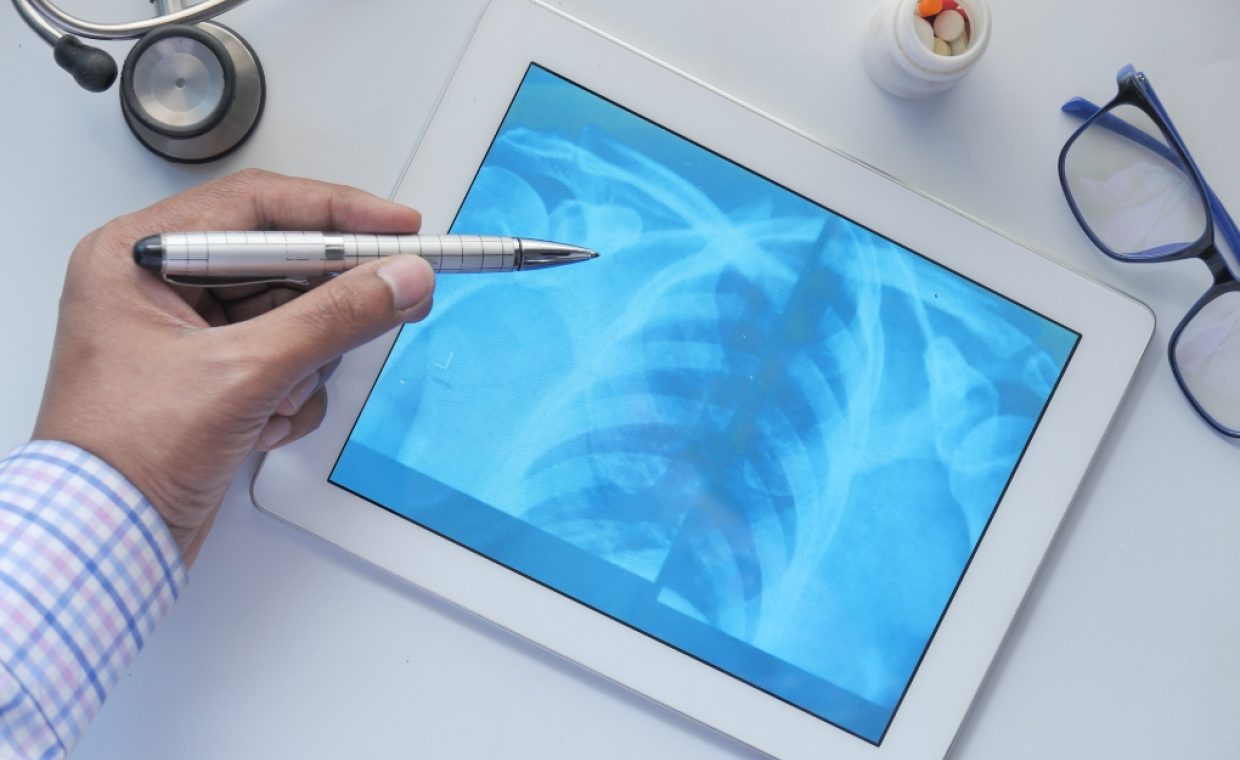 image of a doctor reviewing an x-ray of a chest viewed on a tablet 