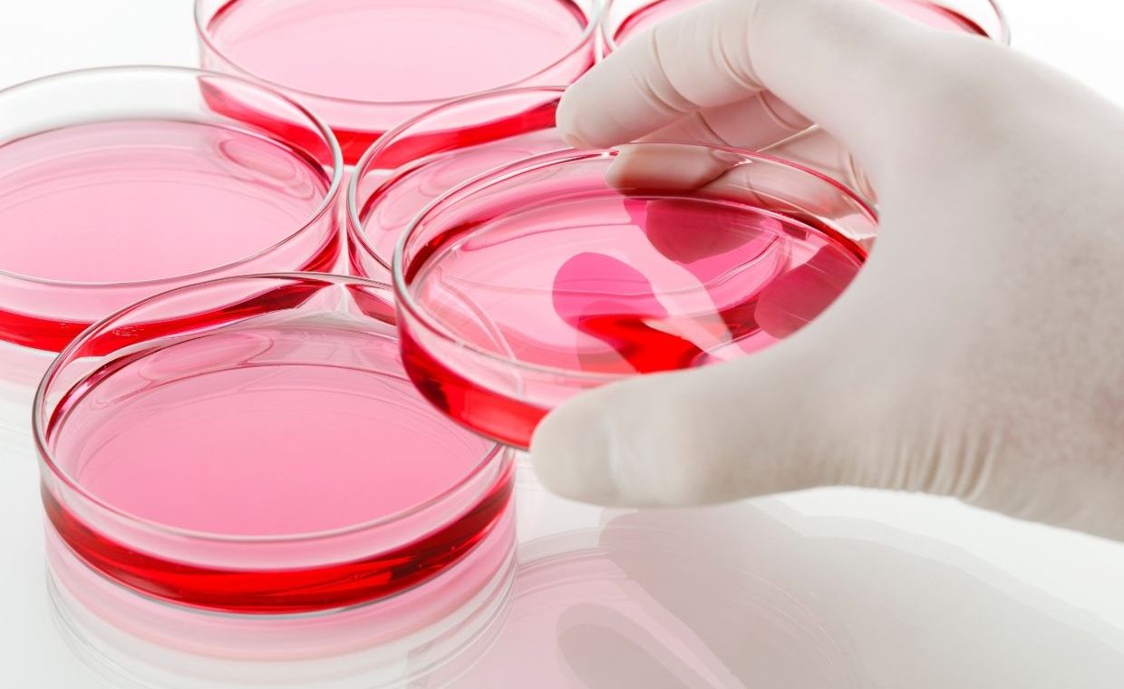 A hand in a white latex glove picks up one petri dish with pink gel out of a double row of similar dishes