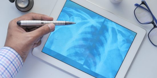 image of a doctor reviewing an x-ray of a chest viewed on a tablet 