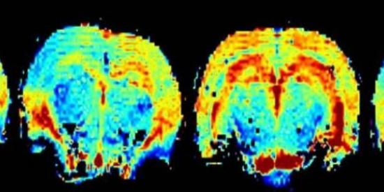 Young Neuroscientists Symposium 