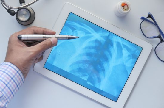 image of a doctor reviewing an x-ray of a chest viewed on a tablet 